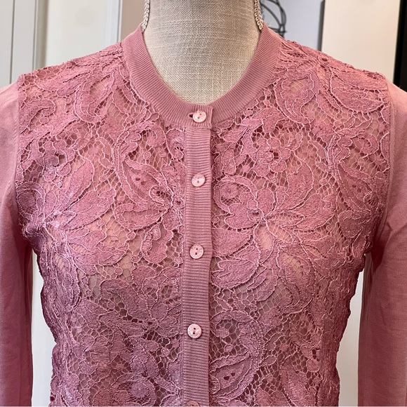 Pink Lace Cardigan - Picture 4 of 8
